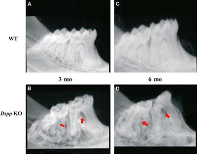 The Role of SIBLING Proteins in Dental, Periodontal, and Craniofacial Development